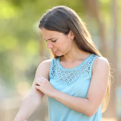 woman annoyed by mosquitoes